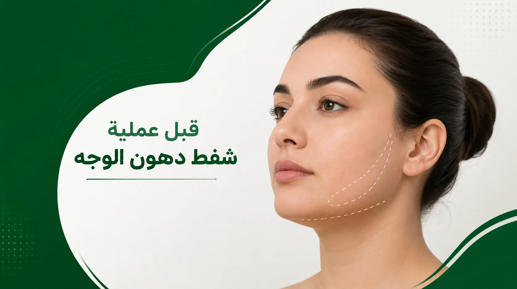 قبل عملية شفط دهون الوجه